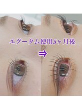 ベリー(BERRY)/エグータム５ヶ月使用