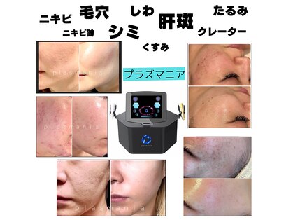 ビューティーネイル(Beauty Nail)の写真