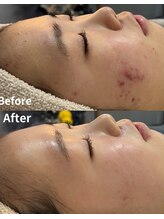 スリリアン 銀座/★お客さまビフォーアフター★