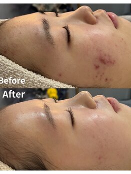 スリリアン 銀座/★お客さまビフォーアフター★