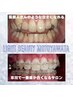【矯正後・矯正中の方限定】矯正割！！30分照射☆500円引き2470円！