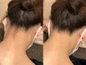【レディース限定】うなじWAX脱毛