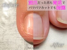 ナル(Nalu.)/今の爪から変われます！