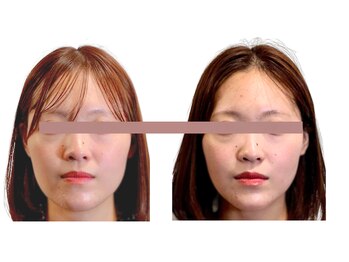 東麻布アマン(東麻布Aman)/一度での変化