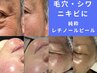 ハリ艶爆上げ！【目尻のシワ・毛穴開き改善ご希望の方】肌の新陳代謝を正常化