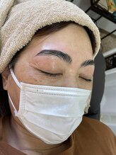 ルアナ(Ruana)/ハリウッドブロウリフト