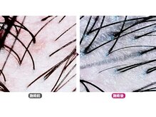 ワヤンプリ 麻布十番店/頭皮スコープ診断[港区/麻布]