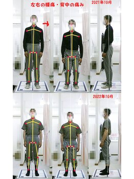 姫路なごみ整体院 なごみ鍼灸院/改善例（仙腸関節.痛や手首痛み