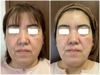 ソイズ 上中居店(SOIS)/レモンボトル