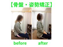 トキワ(TOKIWA)の雰囲気（骨盤を整えて美姿勢に！肩こり、巻き肩、猫背にも効果的！）