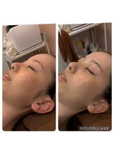 スリーズララ 大船駅前店(Cerise LaLa)/◆うるつや美肌ララピール