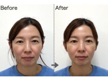 美容整体すこやか/【初回の流れ】