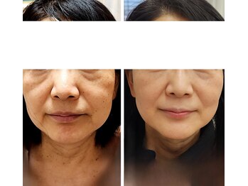 越前屋/TGFエッセンス