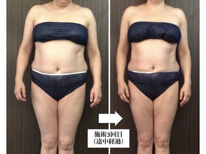 バーテックスキー(Vertexkey)の写真