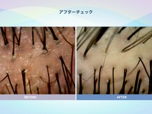 アンス(anth:)/お客様の仕上がり