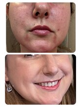 エーエフビューティーエステ(AF Beauty Esthetic)/肌が変わると人生も変わる