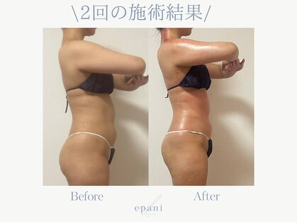 エパニ(epani)の写真