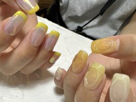 アシメイエロー