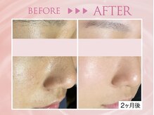 クリアラボ 川崎(Clear Lab)/韓国式肌管理&毛穴洗浄専門店