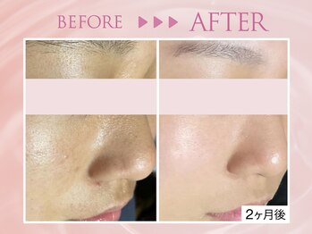 クリアラボ 川崎(Clear Lab)/韓国式肌管理&毛穴洗浄専門店