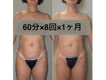 ユリノコ(YURINOKO)の雰囲気（お得な短期集中クーポン発行中♪60分×8回で56,000円(現金限定)）
