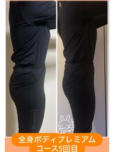 ヨサパーク ミミン(YOSA PARK mimin)/全身ボディプレミアムコース変化