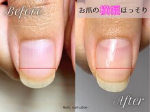 ナル(Nalu.)/お爪の横幅すほっそり♪