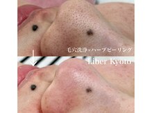 リベルキョウト 京都駅前店(Liber Kyoto)/毛穴レス艶肌