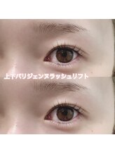 レディエント(Radiant)/上下パリジェンヌラッシュリフト