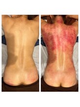 タイ古式マッサージ チェンマイ/研修