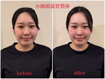 コリニック 香椎店/小顔頭蓋骨整体
