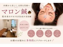 グロース鍼灸整骨院 豊浜院の雰囲気（【岡山県初】マロン美容鍼100本以上の鍼を使い根本改善）