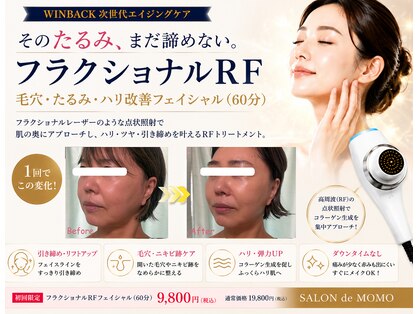 サロンドモモ(SALON de MOMO)の写真