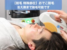 イエス 東京池袋店(YES)/【特殊部位】おでこ脱毛