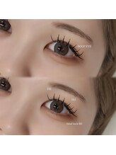 ルーフアイ(ROOF EYE)/ROOF EYE(ルーフ アイ)