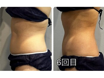 ラヴィエール(Laviere)/【レディース痩身120分】