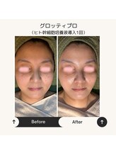 ボディケアサロン アイリフ(airef)/ビフォーアフター