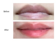 オーシャンブルー 長崎店(OCEAN BLUE)/最新黒ずみケア《ローマピンク》