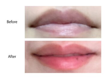 オーシャンブルー 長崎店(OCEAN BLUE)/最新黒ずみケア《ローマピンク》