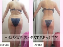 エストビューティー 池袋店(EST BEAUTY)