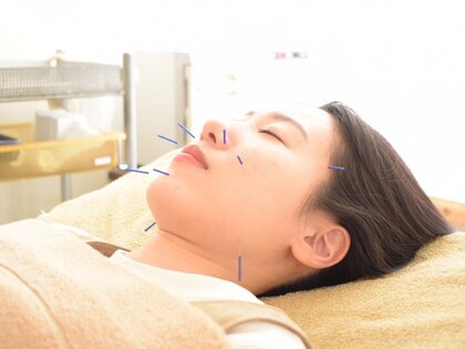 パドマ鍼灸治療院(padma鍼灸治療院)の写真