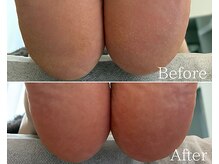 カシェット 広島店(Cachette)/30代女性☆足裏角質ケア90分