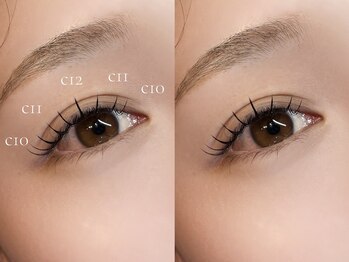 BMJ/フラットラッシュ100本