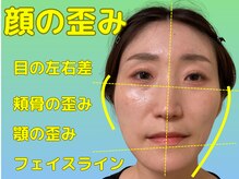 ナチュラルパーフェクトフェイス 新宿/顔の歪みを整え/新宿駅小顔矯正