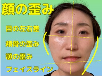 ナチュラルパーフェクトフェイス 新宿/顔の歪みを整え/新宿駅小顔矯正