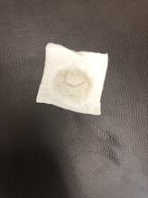 シャンデル(Shandell)/毛穴に潜む汚れ達