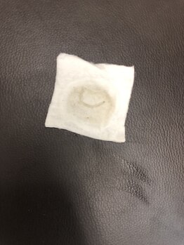 シャンデル(Shandell)/毛穴に潜む汚れ達