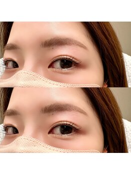 エニー アイラッシュ 筑紫口店(ANY Eyelash)/setメニュー