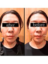 美バリ 新宿店(美BARI)/一回で小顔に