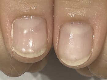 グレースレディ 神戸北店/